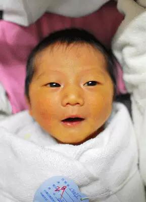 治疗新生儿黄疸最有效的办法,新生儿黄疸怎么造成的