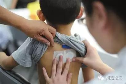 招远最强“三伏贴”攻略来啦!拿走不谢!