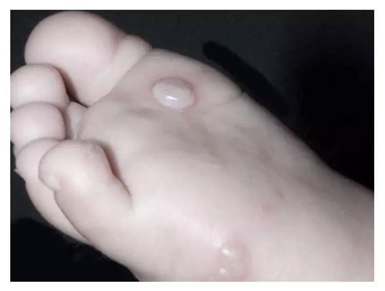 主持人乌小兰给宝宝的小脚丫除臭小偏方