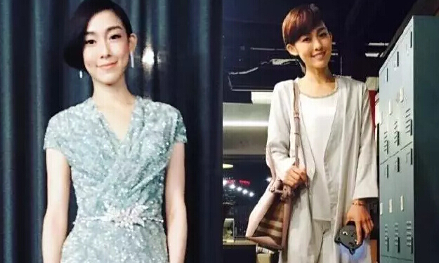 她们“肿”了,都是因为苹果肌惹的祸!