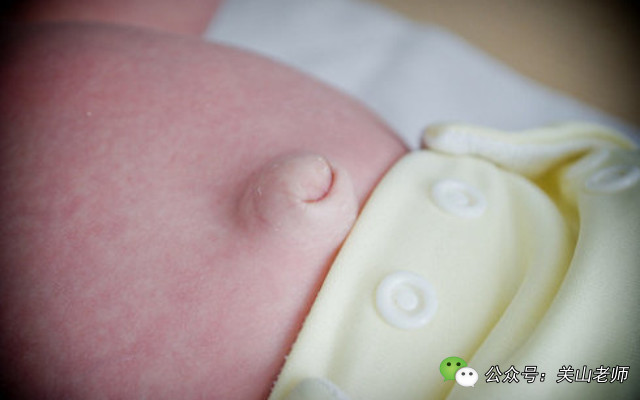 一哭就鼓起来并伴有咕咕声的肚脐，你家宝宝出现了吗？
