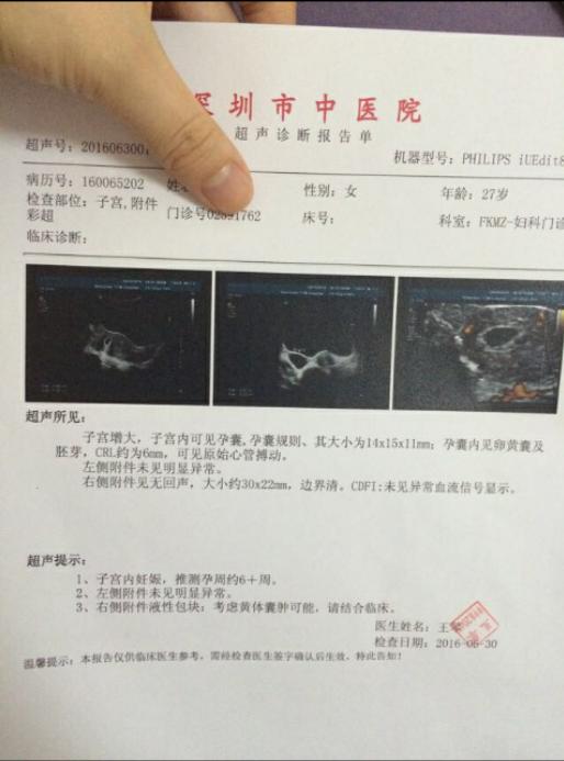 孕酮不涨流褐色物成功有胎心连医生都说是奇迹