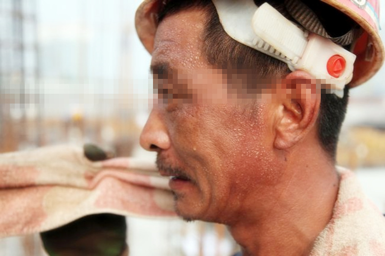 他腹痛发热三天，全身突然变黄，医生只看一眼就明白了！