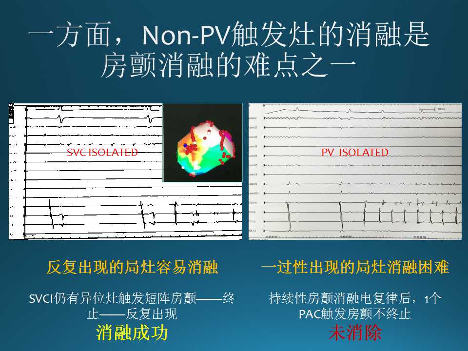 仁济医院射频消融王新华,王新华主要事迹