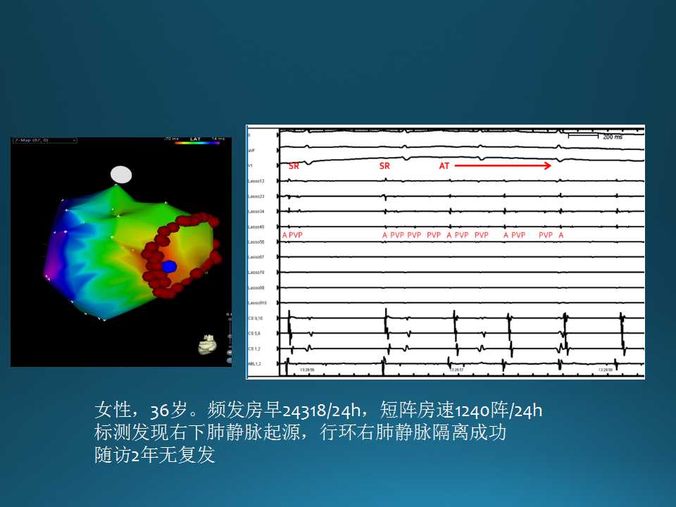 仁济医院射频消融王新华,王新华主要事迹
