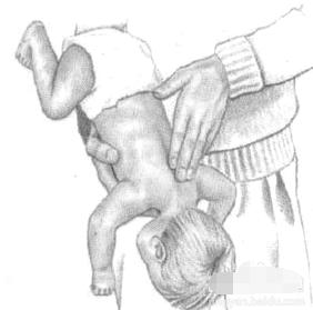 小孩喉咙卡住海姆立克急救法教学,小孩异物卡喉海姆立克急救法