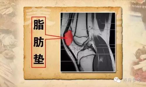 膝盖疼痛抽筋用什么药,腿膝盖突然疼痛像抽筋怎么治疗