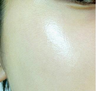 痘印难消吃什么维生素,痘印难消