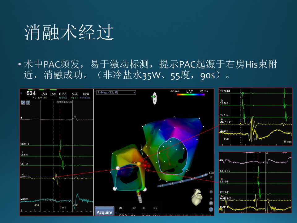 仁济医院射频消融王新华,王新华主要事迹