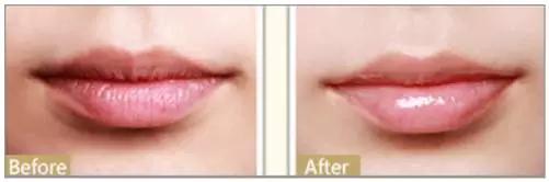 天津美莱年中盛典,天津美莱医学美容旗舰店