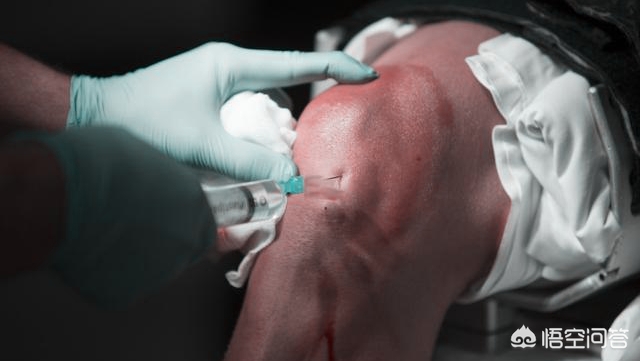 左腿韧带撕裂是什么感觉,左腿韧带撕裂手术后怎么保护