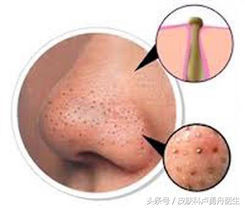 直播间关于面子的话题,直播面子问题