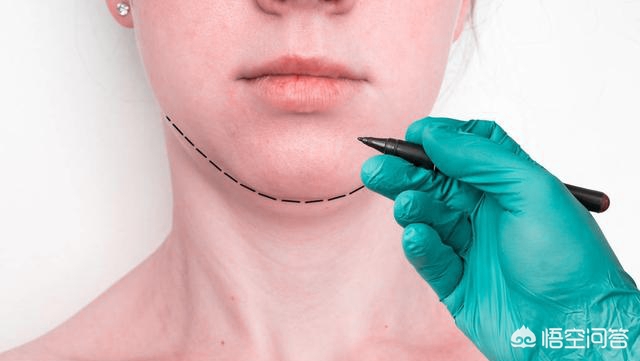 下颌骨不对称手术,下颌骨不对称可以矫正吗