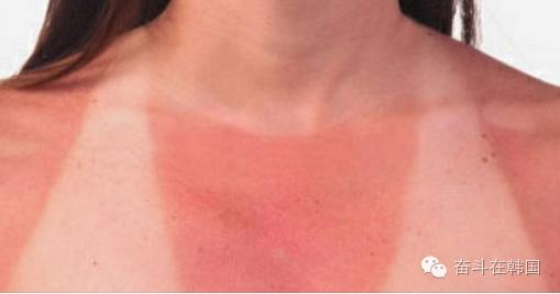 晒后怎么修复效果最好,晒后修复绝招视频教程