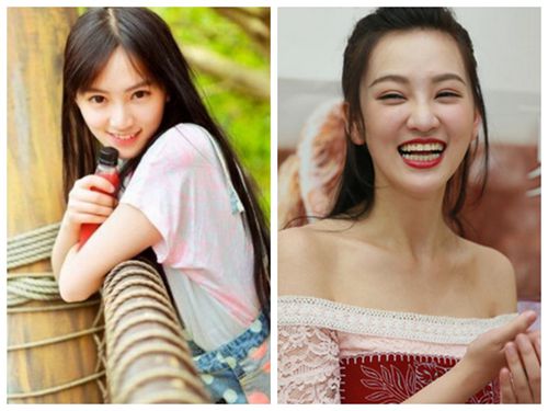 她们“肿”了,都是因为苹果肌惹的祸!