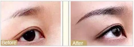 天津美莱年中盛典,天津美莱医学美容旗舰店