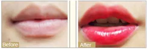 天津美莱年中盛典,天津美莱医学美容旗舰店