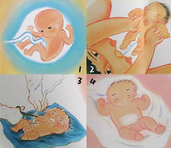 肚脐眼臭臭的东西是粑粑吗,肚脐眼里的粑粑到底能不能抠出来