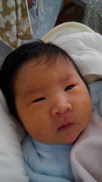 二胎剖腹产直接结扎行吗,剖腹产结扎经历分享