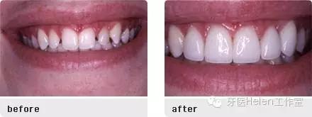 helen榻跨榛勭拹,helen鐗欑