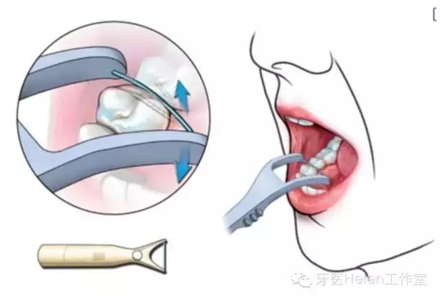 牙医亲自示范牙线使用,牙医建议使用水牙线吗