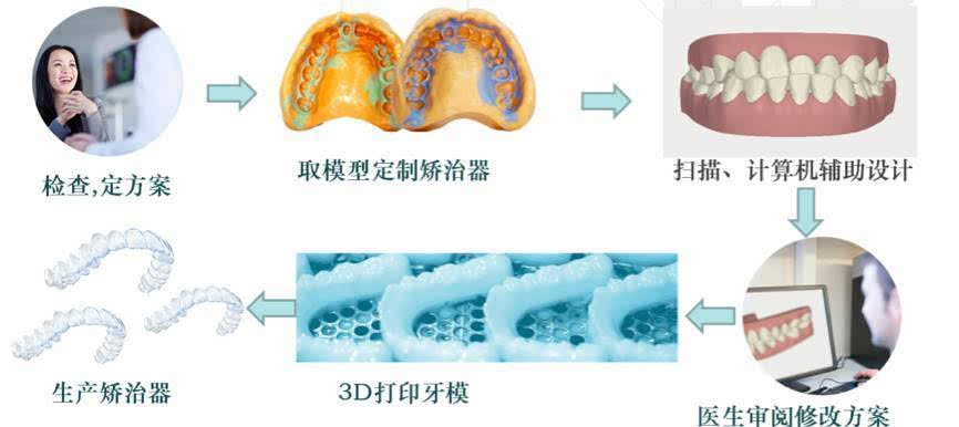 岳云鹏有牙套吗,小岳岳整牙
