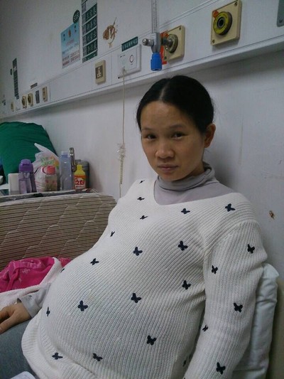 二胎剖腹产直接结扎行吗,剖腹产结扎经历分享