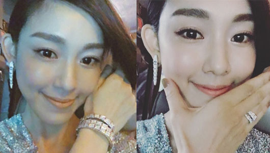 她们“肿”了,都是因为苹果肌惹的祸!