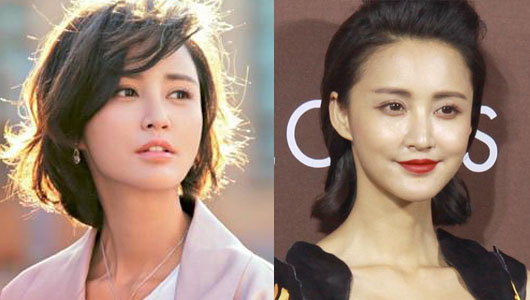 她们“肿”了,都是因为苹果肌惹的祸!