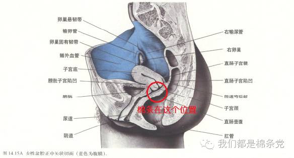 你不可不知的棉条小知识-棉芯是什么？