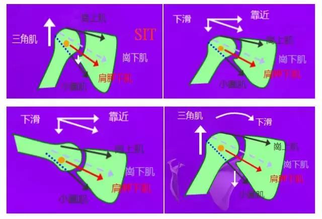 肩部撞击症,肩部撞击怎么康复