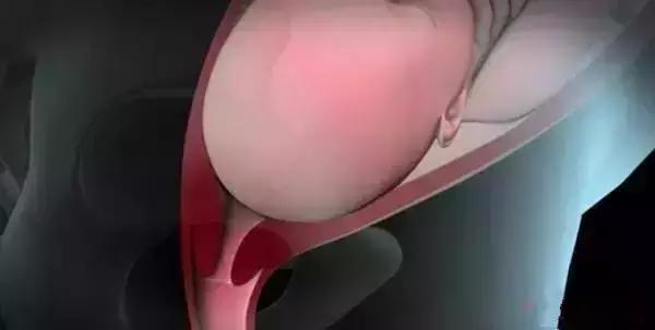 顺产分娩全过程想顺产的你一定想知道！