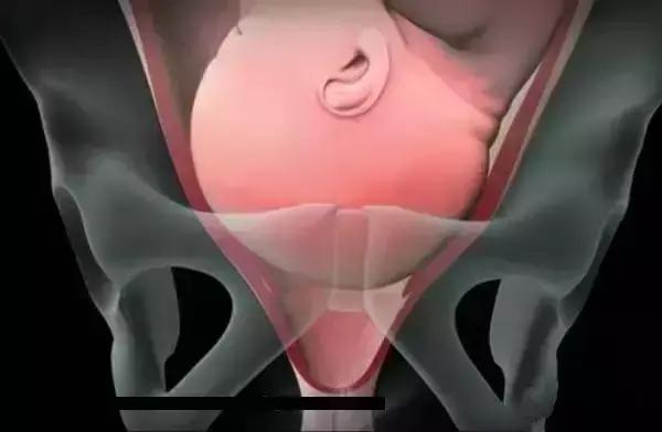 顺产分娩全过程想顺产的你一定想知道！