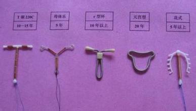 女性被逼在子宫腔内上环：不人性化，对女性的摧残！