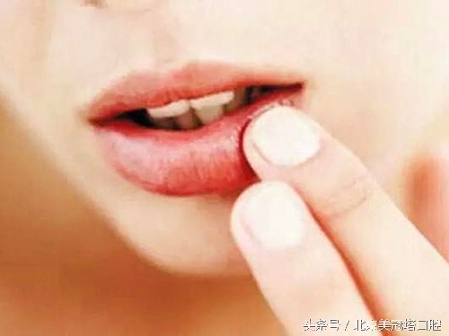 夏天嘴角老烂是什么原因,夏天嘴角烂了怎样好得快