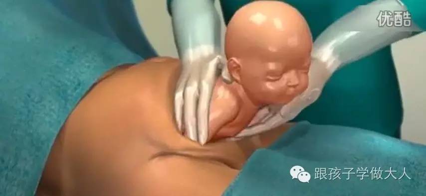 一些关于剖腹产的细节你知道多少,剖腹产最难的一个步骤