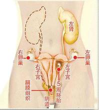 双子宫孕妈产子命悬一线,产检多次医生竟未查出异常