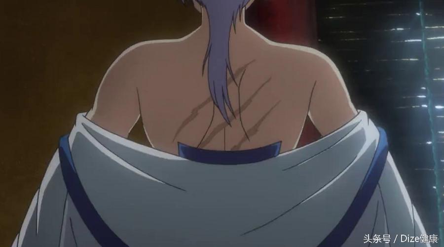 如何防止疤痕形成的小妙招,如何避免疤痕留印