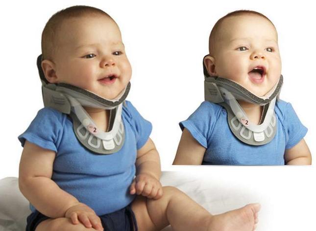 宝宝斜颈怎么治疗,宝宝斜颈怎么矫正最好