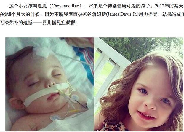 宝宝斜颈怎么治疗,宝宝斜颈怎么矫正最好