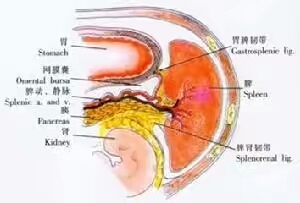 他外伤后脾破裂腹腔出血,妻子的一句话他拒绝了医生住院要求。