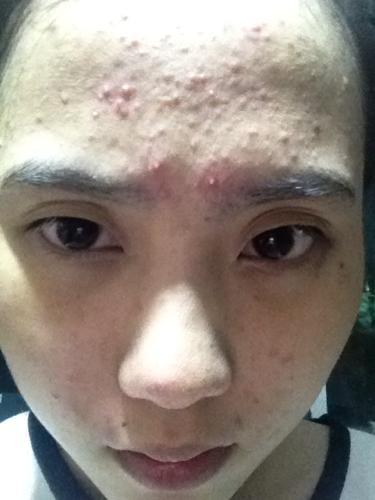 秋冬的肌肤干燥不稳定,夏日肌肤干燥怎么保持