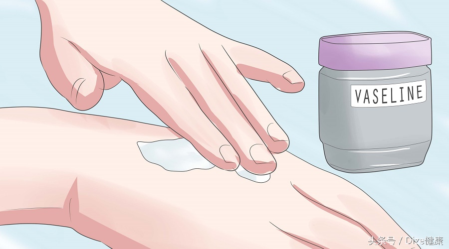 如何防止疤痕形成的小妙招,如何避免疤痕留印