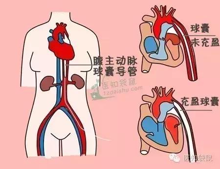 怀孕前必须治好这三种病,怀孕期间会得哪些慢性疾病