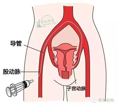 怀孕前必须治好这三种病,怀孕期间会得哪些慢性疾病