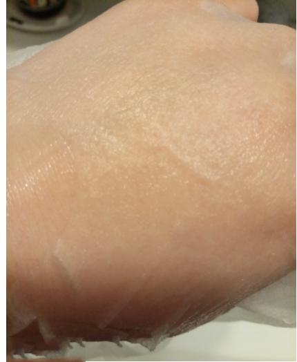 wis痘肌面膜真的有效吗,wis痘肌修护面膜