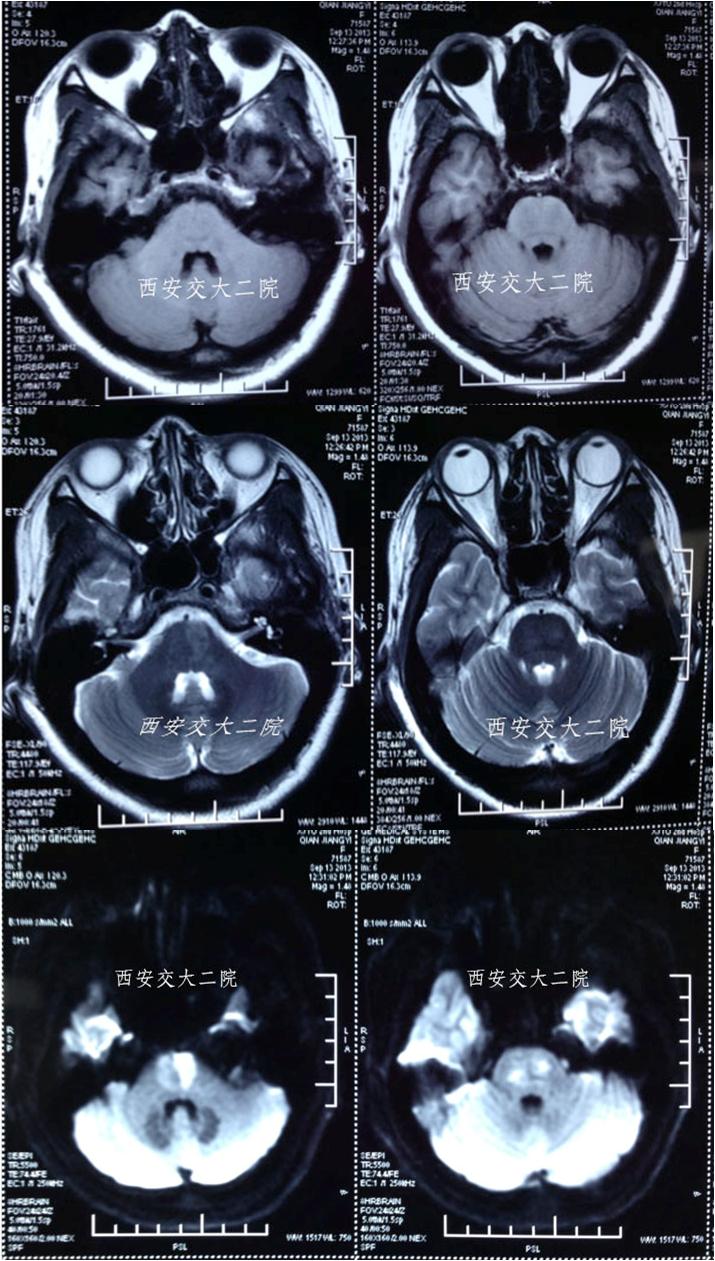 介入科病例,介入手术的健康科普方案