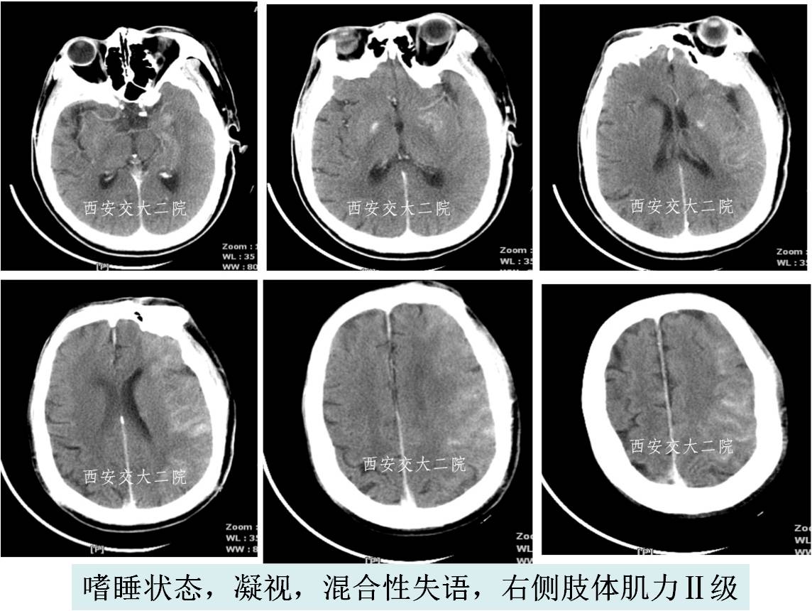 介入科病例,介入手术的健康科普方案