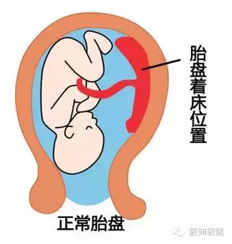 怀孕前必须治好这三种病,怀孕期间会得哪些慢性疾病