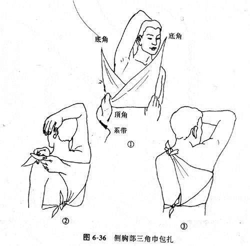 三种包扎法的注意事项,受伤各种包扎法